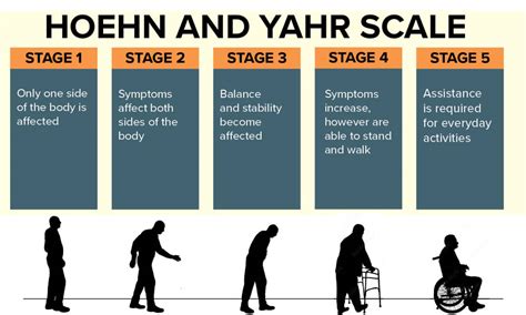 parkinson's disease stages hoehn and yahr